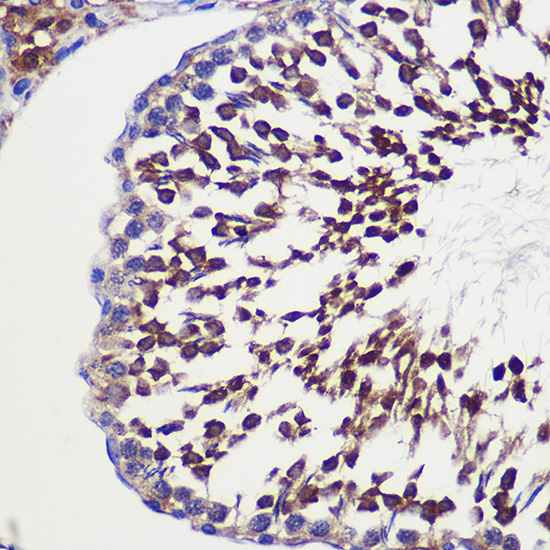 Immunohistochemistry of paraffin-embedded Rat testis using TUBGCP6 Polyclonal Antibody at dilution of 1:100 (40x lens).Perform microwave antigen retrieval with 10 mM PBS buffer pH 7.2 before commencing with IHC staining protocol.