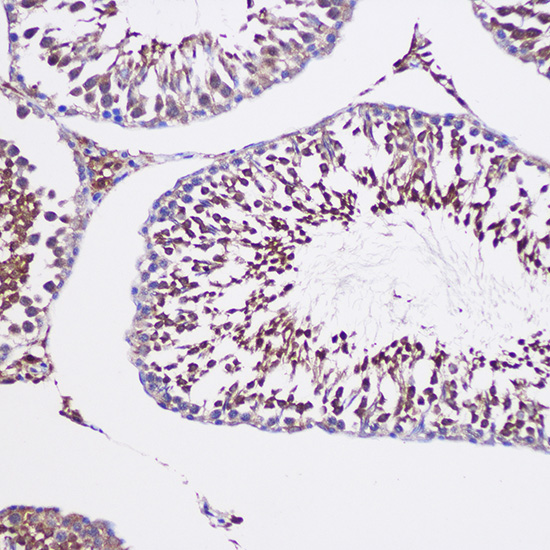 Immunohistochemistry of paraffin-embedded Rat testis using TUBGCP6 Polyclonal Antibody at dilution of 1:100 (20x lens).Perform microwave antigen retrieval with 10 mM PBS buffer pH 7.2 before commencing with IHC staining protocol.