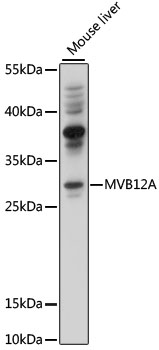 Western blot analysis of extracts of mouse liver using MVB12A Polyclonal Antibody at 1000 dilution.