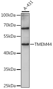 Western blot analysis of extracts of A-431 cells using TMEM44 Polyclonal Antibody at 1:1000 dilution.