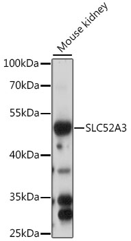 Western blot analysis of extracts of mouse kidney using SLC52A3 Polyclonal Antibody at 1:1000 dilution.