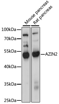 Western blot analysis of extracts of various cell lines using AZIN2 Polyclonal Antibody at 1000 dilution.