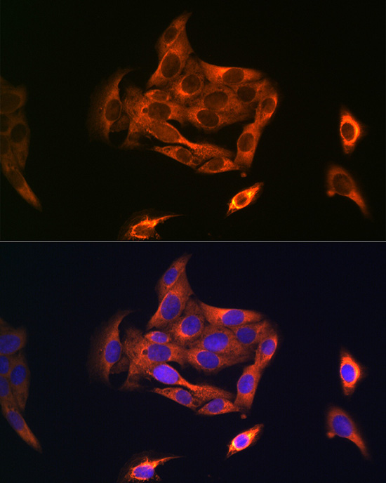 Immunofluorescence analysis of U2OS cells using NOSTRIN Polyclonal Antibody at dilution of 1:100 (40x lens). Blue: DAPI for nuclear staining.