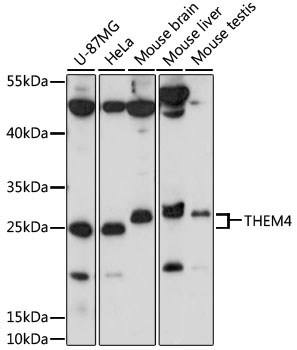 Western blot analysis of extracts of various cell lines using THEM4 Polyclonal Antibody at 1000 dilution.