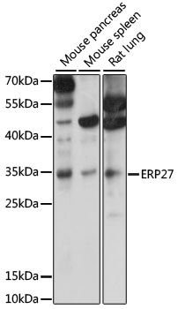 Western blot analysis of extracts of various cell lines using ERP27 Polyclonal Antibody at 1000 dilution.