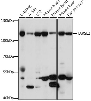 Western blot analysis of extracts of various cell lines using TARSL2 Polyclonal Antibody at 1:1000 dilution.