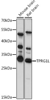 Western blot analysis of extracts of various cell lines using TPRG1L Polyclonal Antibody at 1:1000 dilution.