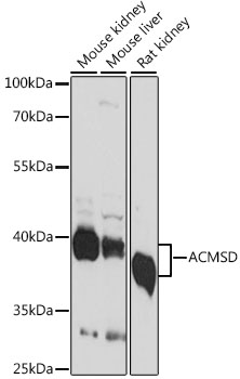 Western blot analysis of extracts of various cell lines using ACMSD Polyclonal Antibody at 1:1000 dilution.