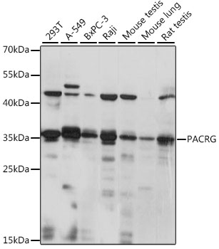 Western blot analysis of extracts of various cell lines using PACRG Polyclonal Antibody at 1:1000 dilution.