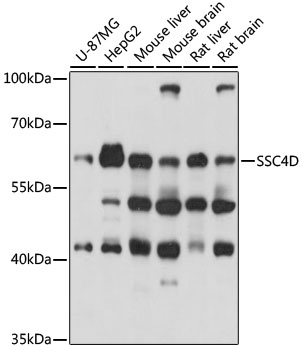 Western blot analysis of extracts of various cell lines using SSC4D Polyclonal Antibody at 1000 dilution.