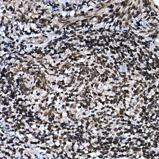 Immunohistochemistry of paraffin-embedded human tonsil using ZNF384 Polyclonal Antibody at dilution of 1:100 (40x lens).Perform high pressure antigen retrieval with 10 mM citrate buffer pH 6.0 before commencing with IHC staining protocol.