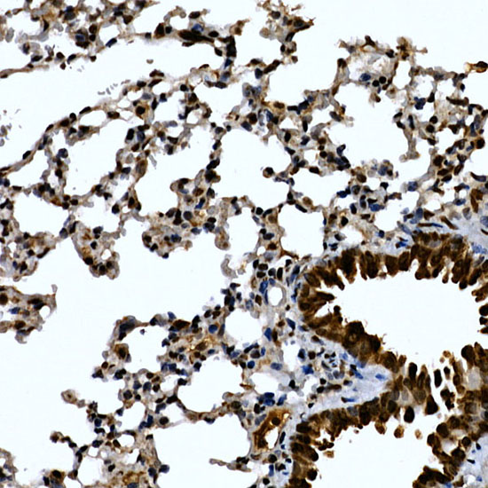 Immunohistochemistry of paraffin-embedded mouse lung using ZNF384 Polyclonal Antibody at dilution of 1:100 (40x lens).Perform high pressure antigen retrieval with 10 mM citrate buffer pH 6.0 before commencing with IHC staining protocol.