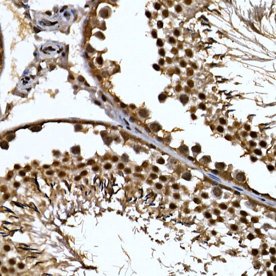 Immunohistochemistry of paraffin-embedded rat testis using ZNF384 Polyclonal Antibody at dilution of 1:100 (40x lens).Perform high pressure antigen retrieval with 10 mM citrate buffer pH 6.0 before commencing with IHC staining protocol.