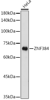 Western blot analysis of extracts of HeLa cells using ZNF384 Polyclonal Antibody at 1:1000 dilution.