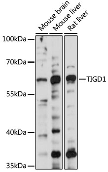 Western blot analysis of extracts of various cell lines using TIGD1 Polyclonal Antibody at 1000 dilution.