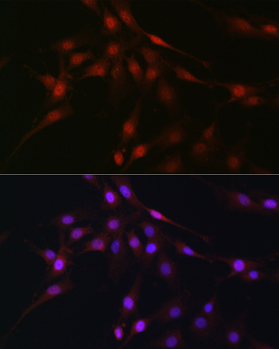 Immunofluorescence analysis of C6 cells using C9orf72 Polyclonal Antibody at dilution of 1:100 (40x lens). Blue: DAPI for nuclear staining.