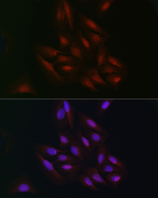 Immunofluorescence analysis of U2OS cells using C9orf72 Polyclonal Antibody at dilution of 1:100 (40x lens). Blue: DAPI for nuclear staining.