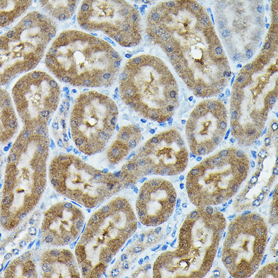 Immunohistochemistry of paraffin-embedded mouse kidney using C9orf72 Polyclonal Antibody at dilution of 1:100 (40x lens).Perform high pressure antigen retrieval with 10 mM citrate buffer pH 6.0 before commencing with IHC staining protocol.