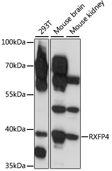 Western blot analysis of extracts of various cell lines using RXFP4 Polyclonal Antibody at 1:1000 dilution.