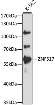 Western blot analysis of extracts of K-562 cells using ZNF517 Polyclonal Antibody at 1:1000 dilution.