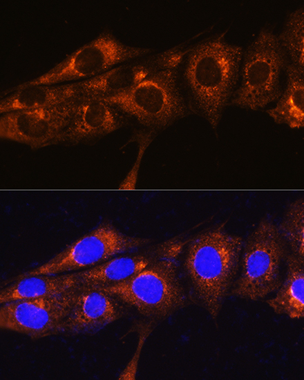 Immunofluorescence analysis of NIH/3T3 cells using FREM2 Polyclonal Antibody at dilution of 1:100. Blue: DAPI for nuclear staining.