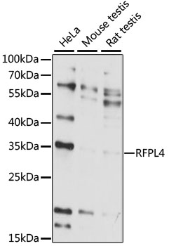 Western blot analysis of extracts of various cell lines using RFPL4 Polyclonal Antibody at 1:1000 dilution.