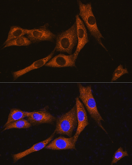 Immunofluorescence analysis of NIH/3T3 cells using GNAT3 Polyclonal Antibody at dilution of 1:100. Blue: DAPI for nuclear staining.