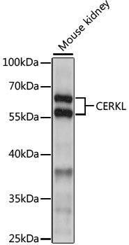 Western blot analysis of extracts of mouse kidney using CERKL Polyclonal Antibody at 1:1000 dilution.