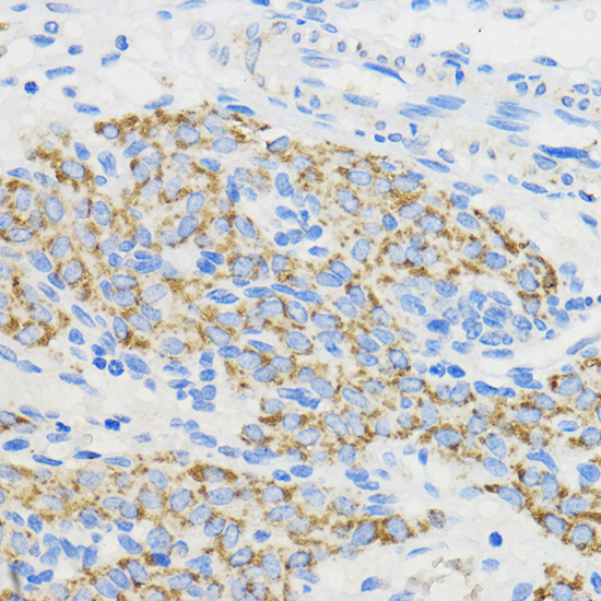 Immunohistochemistry of paraffin-embedded Rat ovary using BOLA3 Polyclonal Antibody at dilution of 1:50 (40x lens).Perform microwave antigen retrieval with 10 mM PBS buffer pH 7.2 before commencing with IHC staining protocol.