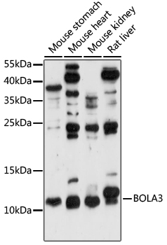 Western blot analysis of extracts of various cell lines using BOLA3 Polyclonal Antibody at 1:1000 dilution.