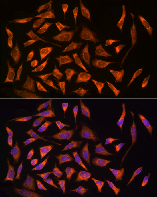 Immunofluorescence analysis of HeLa cells using NOD2 Polyclonal Antibody at dilution of 1:100 (40x lens). Blue: DAPI for nuclear staining.