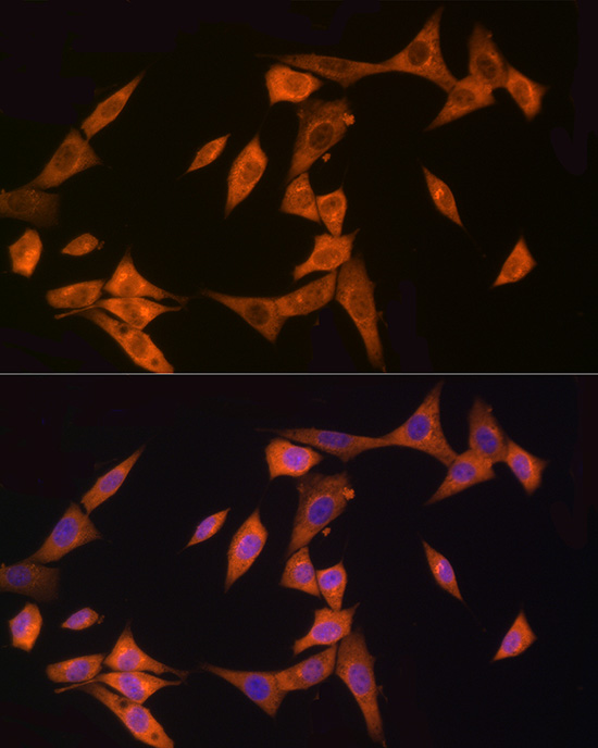 Immunofluorescence analysis of NIH/3T3 cells using NOD2 Polyclonal Antibody at dilution of 1:100 (40x lens). Blue: DAPI for nuclear staining.