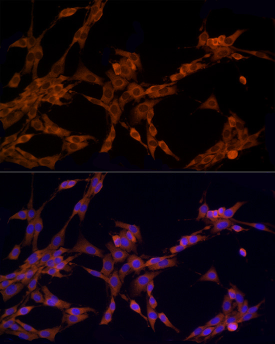 Immunofluorescence analysis of PC-12 cells using NOD2 Polyclonal Antibody at dilution of 1:100 (40x lens). Blue: DAPI for nuclear staining.