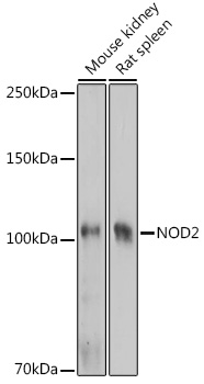 Western blot analysis of extracts of various cell lines using NOD2 Polyclonal Antibody at1:1000 dilution.