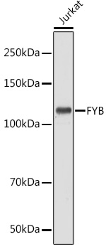 Western blot analysis of extracts of Jurkat cells using FYB Polyclonal Antibody at 1:1000 dilution.