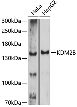 Western blot analysis of extracts of various cell lines using KDM2B Polyclonal Antibody at 1:1000 dilution.