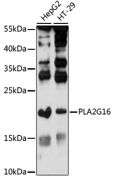 Western blot analysis of extracts of various cell lines using PLA2G16 Polyclonal Antibody at 1:1000 dilution.