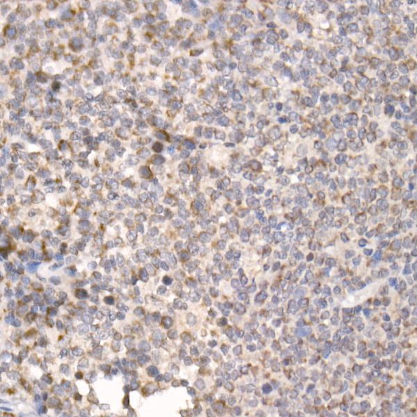 Immunohistochemistry of paraffin-embedded human tonsil using PGAM5 Polyclonal Antibody at dilution of 1:20 (40x lens).Perform high pressure antigen retrieval with 10 mM citrate buffer pH 6.0 before commencing with IHC staining protocol.