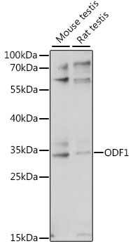 Western blot analysis of extracts of various cell lines using ODF1 Polyclonal Antibody at 1:1000 dilution.