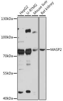 Western blot analysis of extracts of various cell lines using MASP2 Polyclonal Antibody at 1:3000 dilution.