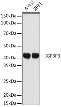 Western blot analysis of extracts of various cell lines using IGFBP3 Polyclonal Antibody at 1:1000 dilution.