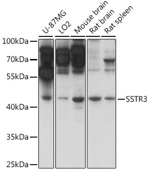 Western blot analysis of extracts of various cell lines using SSTR3 Polyclonal Antibody at 1:1000 dilution.