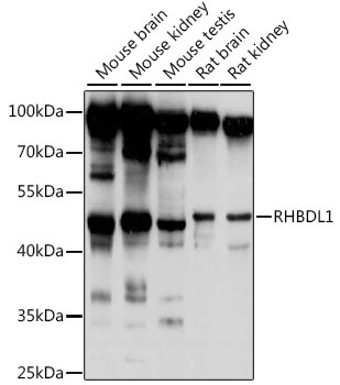 Western blot analysis of extracts of various cell lines using RHBDL1 Polyclonal Antibody at 1:1000 dilution.