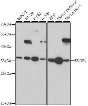 Western blot analysis of extracts of various cell lines using KCNK6 Polyclonal Antibody at 1:1000 dilution.