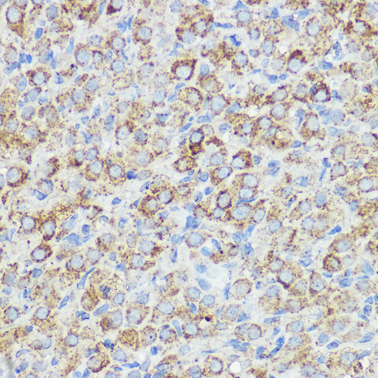 Immunohistochemistry of paraffin-embedded rat ovary using ABI1 Polyclonal Antibody at dilution of 1:50 (40x lens).Perform high pressure antigen retrieval with 10 mM citrate buffer pH 6.0 before commencing with IHC staining protocol.