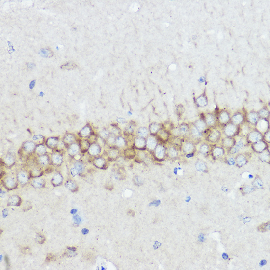 Immunohistochemistry of paraffin-embedded rat brain using ABI1 Polyclonal Antibody at dilution of 1:50 (40x lens).Perform high pressure antigen retrieval with 10 mM citrate buffer pH 6.0 before commencing with IHC staining protocol.