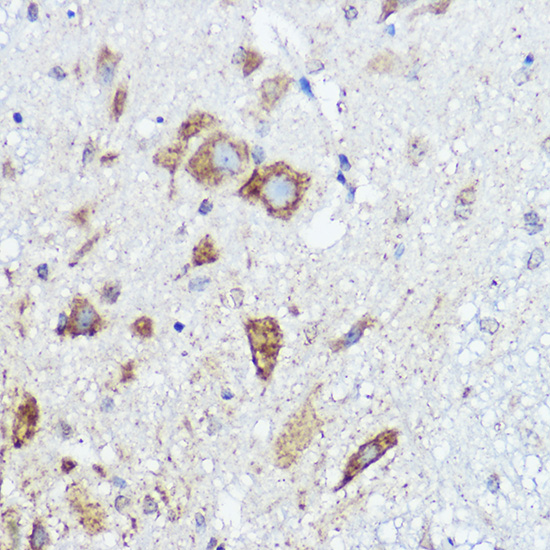 Immunohistochemistry of paraffin-embedded mouse spinal cord using ABI1 Polyclonal Antibody at dilution of 1:50 (40x lens).Perform high pressure antigen retrieval with 10 mM citrate buffer pH 6.0 before commencing with IHC staining protocol.