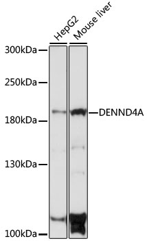 Western blot analysis of extracts of various cell lines using DENND4A Polyclonal Antibody at 1:1000 dilution.