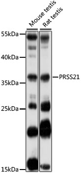 Western blot analysis of extracts of various cell lines using PRSS21 Polyclonal Antibody at 1:1000 dilution.