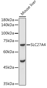 Western blot analysis of extracts of Mouse liver using FATP4/SLC27A4 Polyclonal Antibody at 1:1000 dilution.